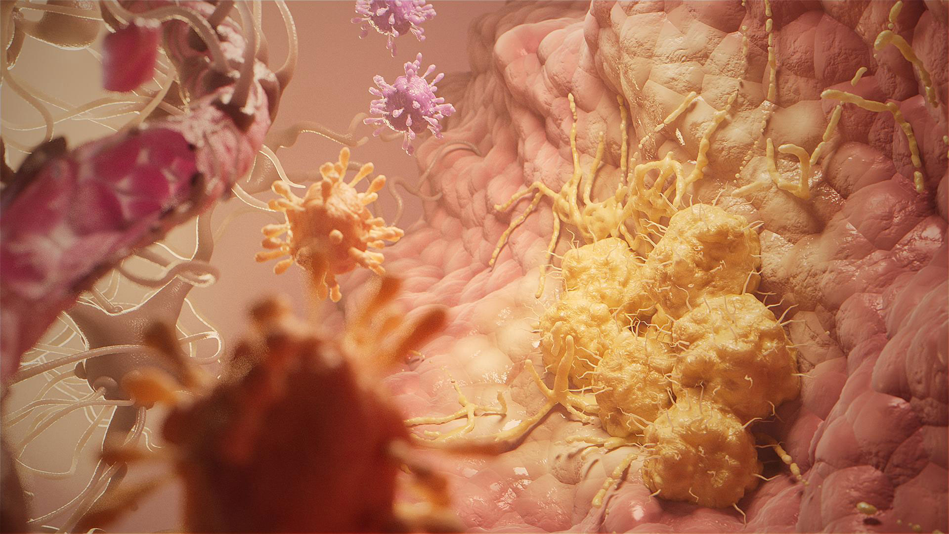 Battling Brain Cancer | Sensu and University of Amsterdam